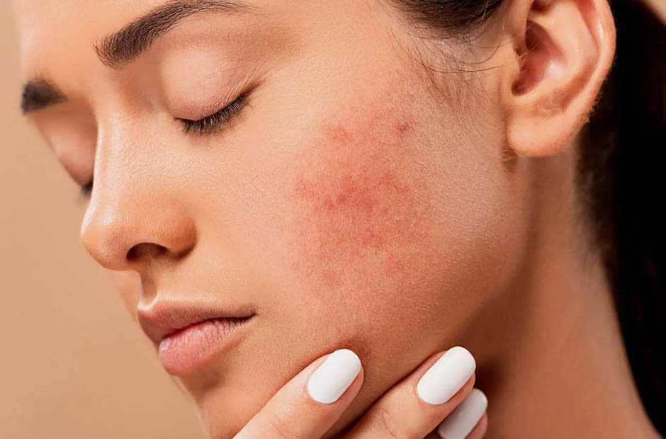 Sensitive Skin Solutions