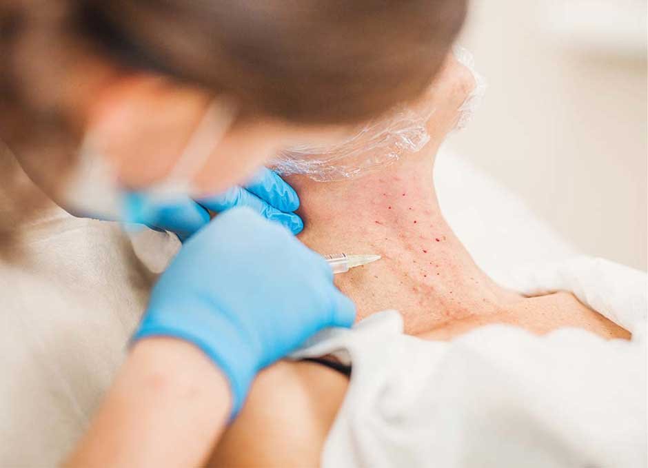 Botox Injections Can Help With Neck Wrinkles and Bands