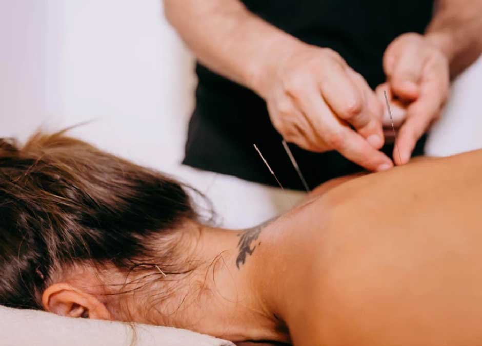 Is acupuncture right for you