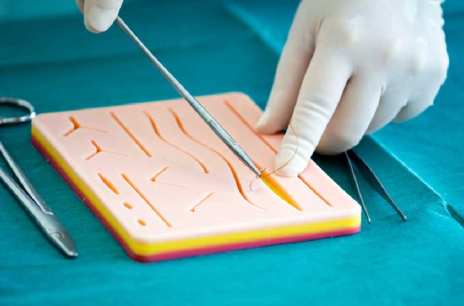 Top Tips for Selecting the Best Surgical Suture Kit for Your Practice